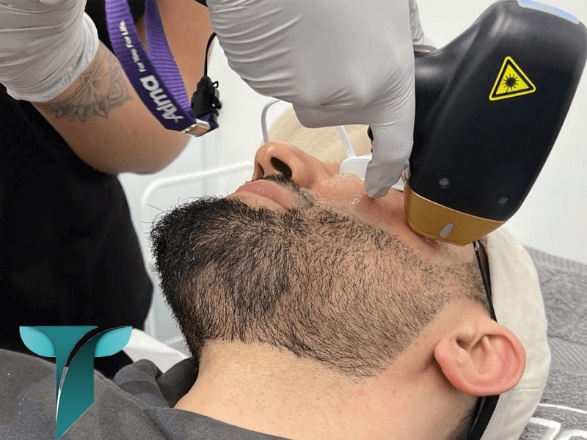 مهمترین نکات در خرید دستگاه لیزر تیتانیوم دست دوم و نو