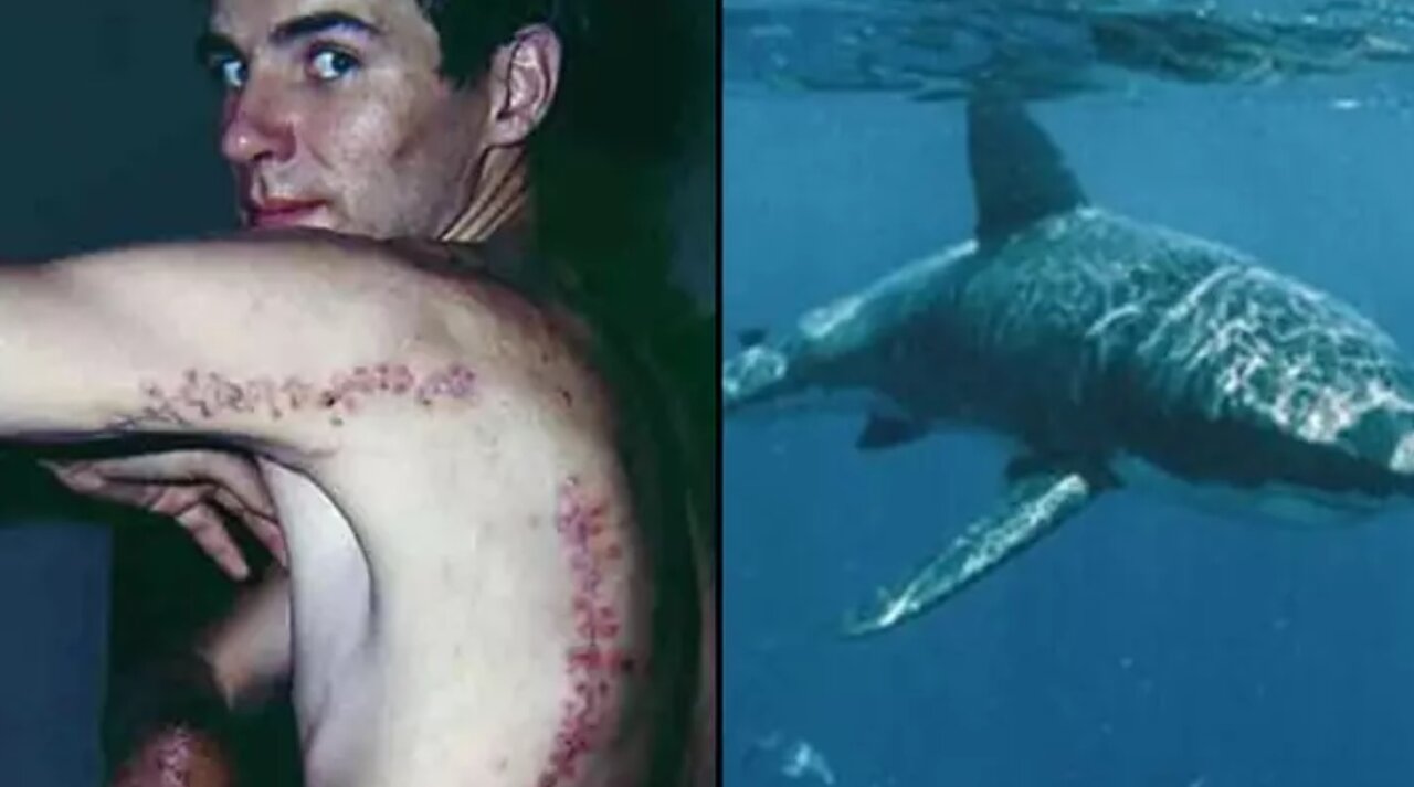 ماجرای مردی که کوسه تکه و پارهاش کرد اما زنده ماند/ عکس