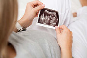 ویدئوی پزشک | ١٢پرسش و پاسخ کوتاه درباره بارداری با تخمک اهدایی 