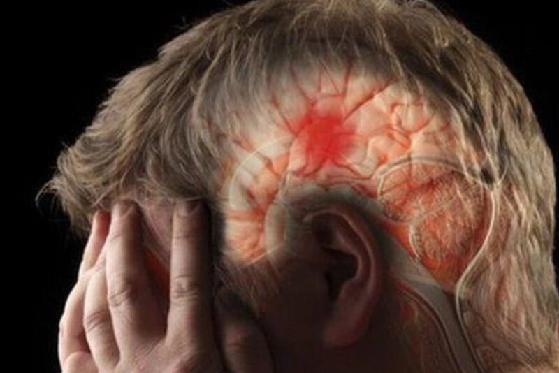 ببینید | جراح‌های مغز اینگونه لخته خون در نزدیکی مغز را از بین می‌برند!
