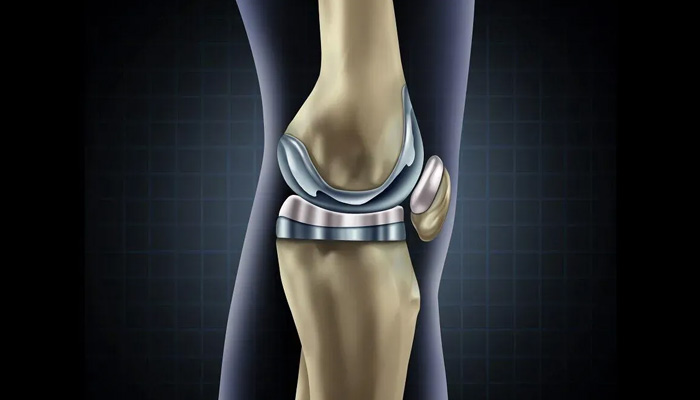 انواع روشهای جراحی زانو را بشناسید