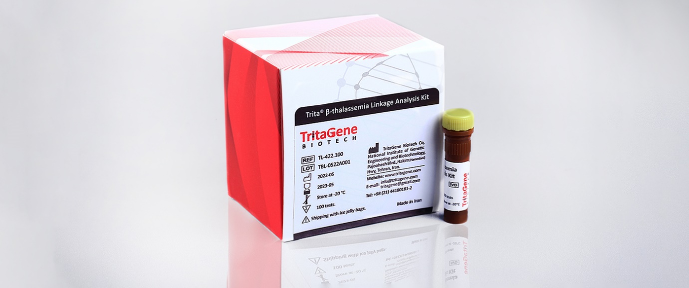 معرفی شرکت تریتاژن، تولیدکننده کیت تشخیص مولکولی انواع سندروم های ژنتیک در کشور