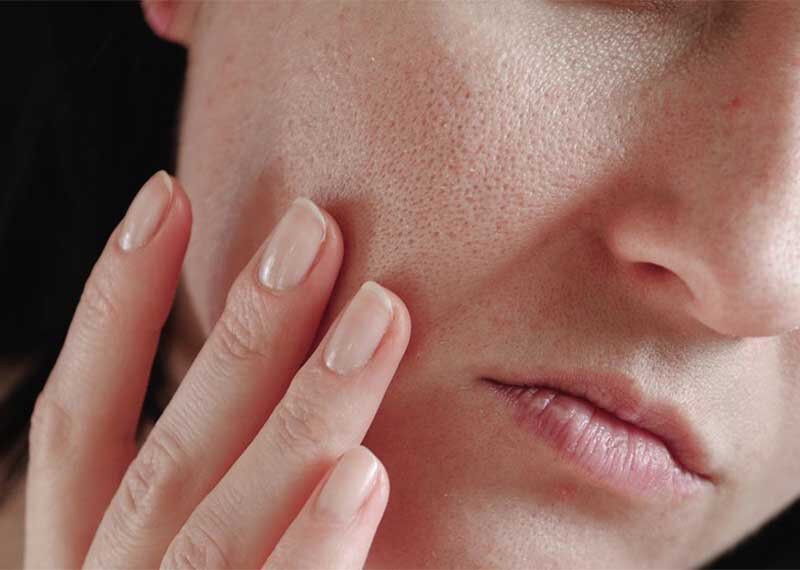 ۵ ضد آفتاب طبیعی برای پوست صورت