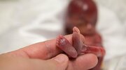 مقابله با سقط جنین در کرمانشاه با کمک «طرح نفس»/آمار سقط جنین نگران کننده است