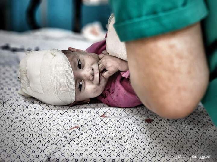 کودکان و نوجوانان، قربانیان اصلی بمباران غزه