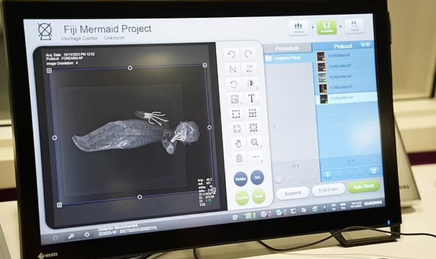 فاش کردن اسرار پری دریایی فیجی با اشعه ایکس/ عکس