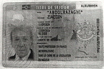 این مرد، دکتر شخصی مسعود رجوی بود /ماساژور و محافظان رجوی کجا زندگی می کنند؟