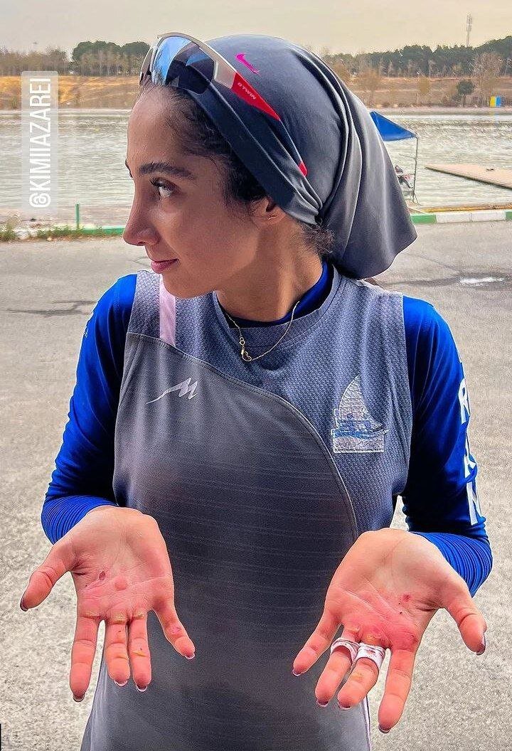 عکس | جراحت دستهای دختر قایقسوار تیم ملی پس از یک تمرین سخت