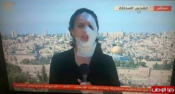عکس | بلایی که اسرائیل بر سر یک خبرنگار زن آورد!