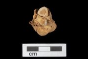 کشف دو دندان عجیب در جسد ۳ هزار ساله یک زن/ عکس