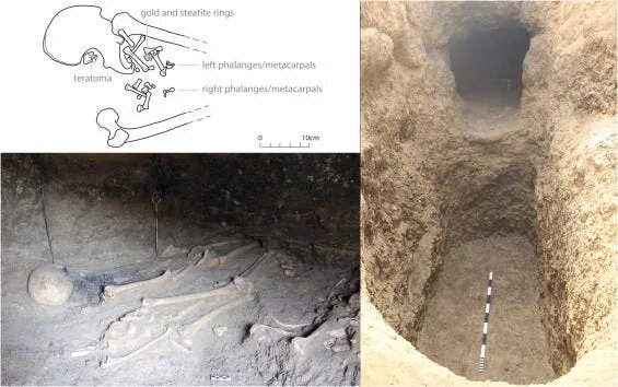 کشف دو دندان عجیب در جسد ۳ هزار ساله یک زن/ عکس