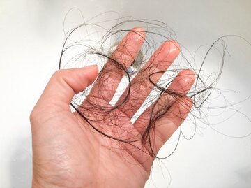 زنان بدانند؛ ۳ راه موثر برای جلوگیری از ریزش مو
