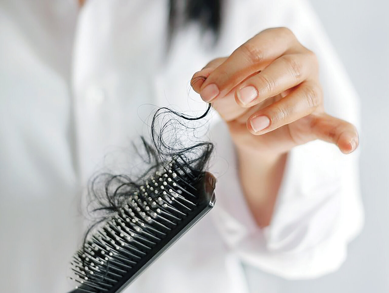 ریزش مو چه زمانی غیرطبیعی است؟/ شایع ترین علل ریزش مو چیست؟