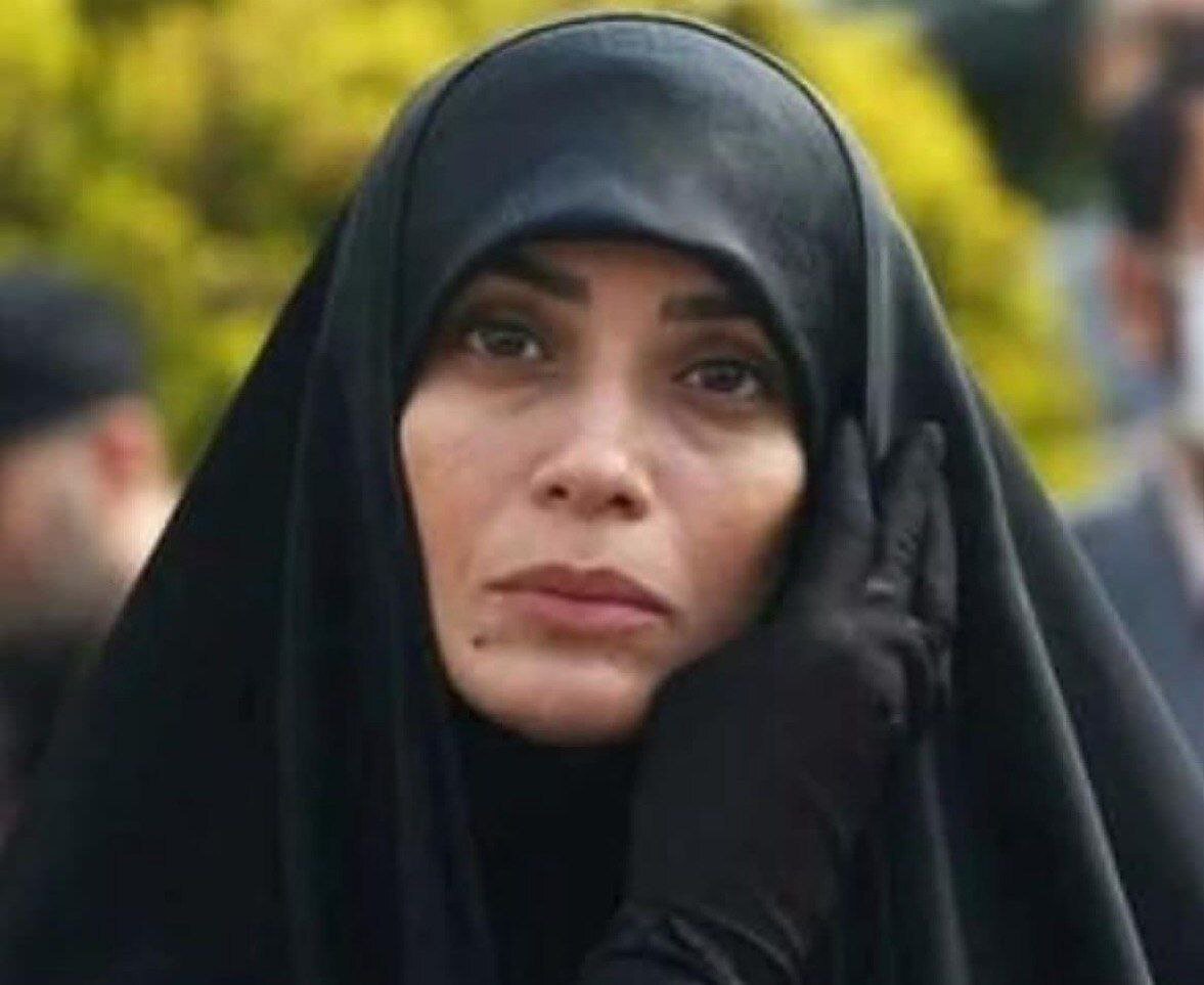 تغییر چهره عجیب الهام چرخنده خبرساز شد/ عکس