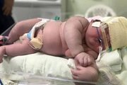 ببینید |  به دنیا آمدن سنگین‌ترین نوزاد ایرانی در مشهد