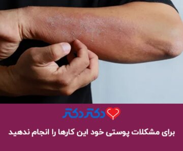 برای مشکلات پوستی خود این 5 کار را انجام ندهید!
