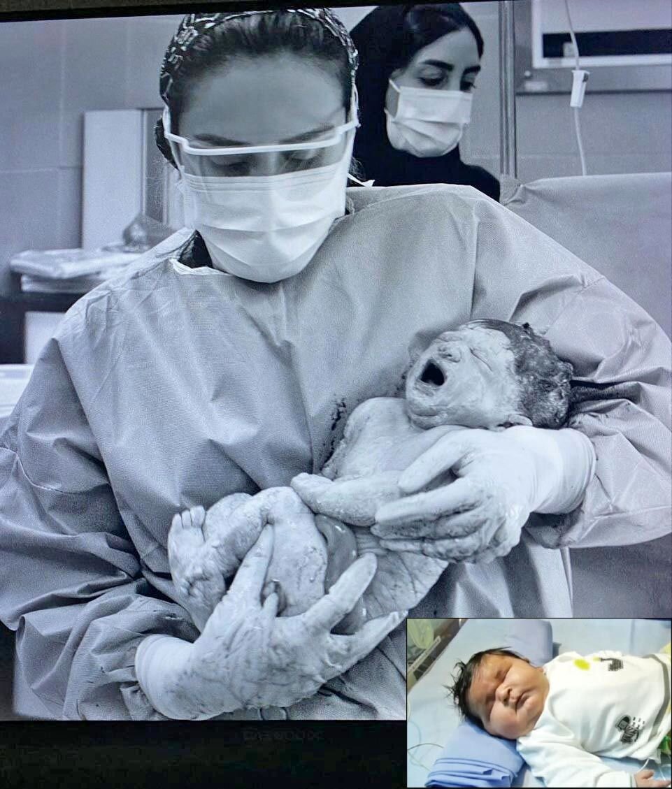 - رکورد تازه برای وزن نوزاد متولدشده در مشهد؛ گفت وگو با پزشکی که نوزاد 7کیلویی را به دنیا آورد