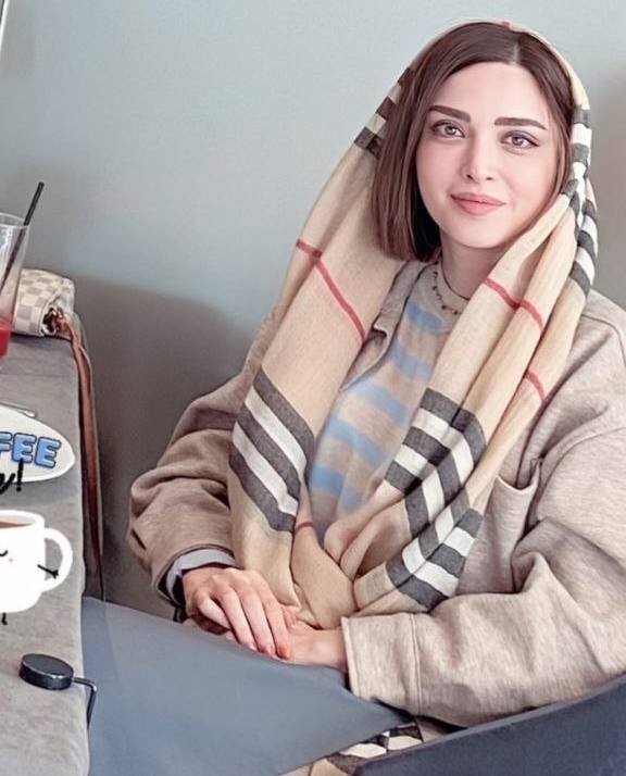 عکس | استوری جدید خانم بازیگر بعد از جراحی پلاستیک کرهای؛ به نظر شما این بازیگر چند سال جوان شده است؟