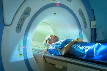 چرا نباید با فلز داخل دستگاه MRI رفت؟/ از این زن بپرسید