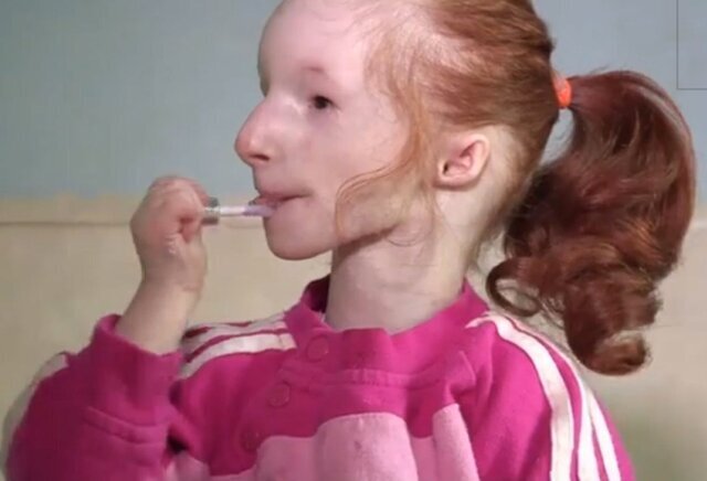 ریز جثهترین دختر دنیا به شانزده سالگی رسید/ عکس