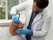 کاشت موی موفق در کلینیک کاشت موی ایران فیت