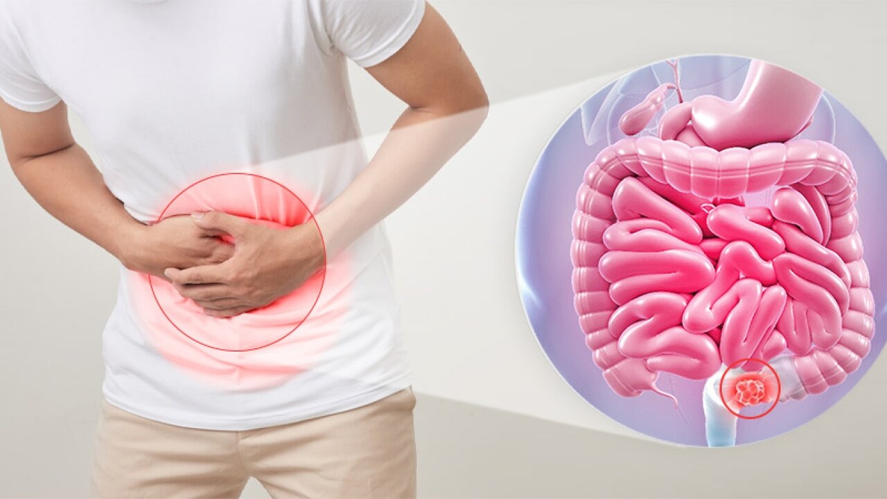 درمانهای طبیعی برای مشکلات روده/ یبوست و نفخ را در خانه درمان کنید