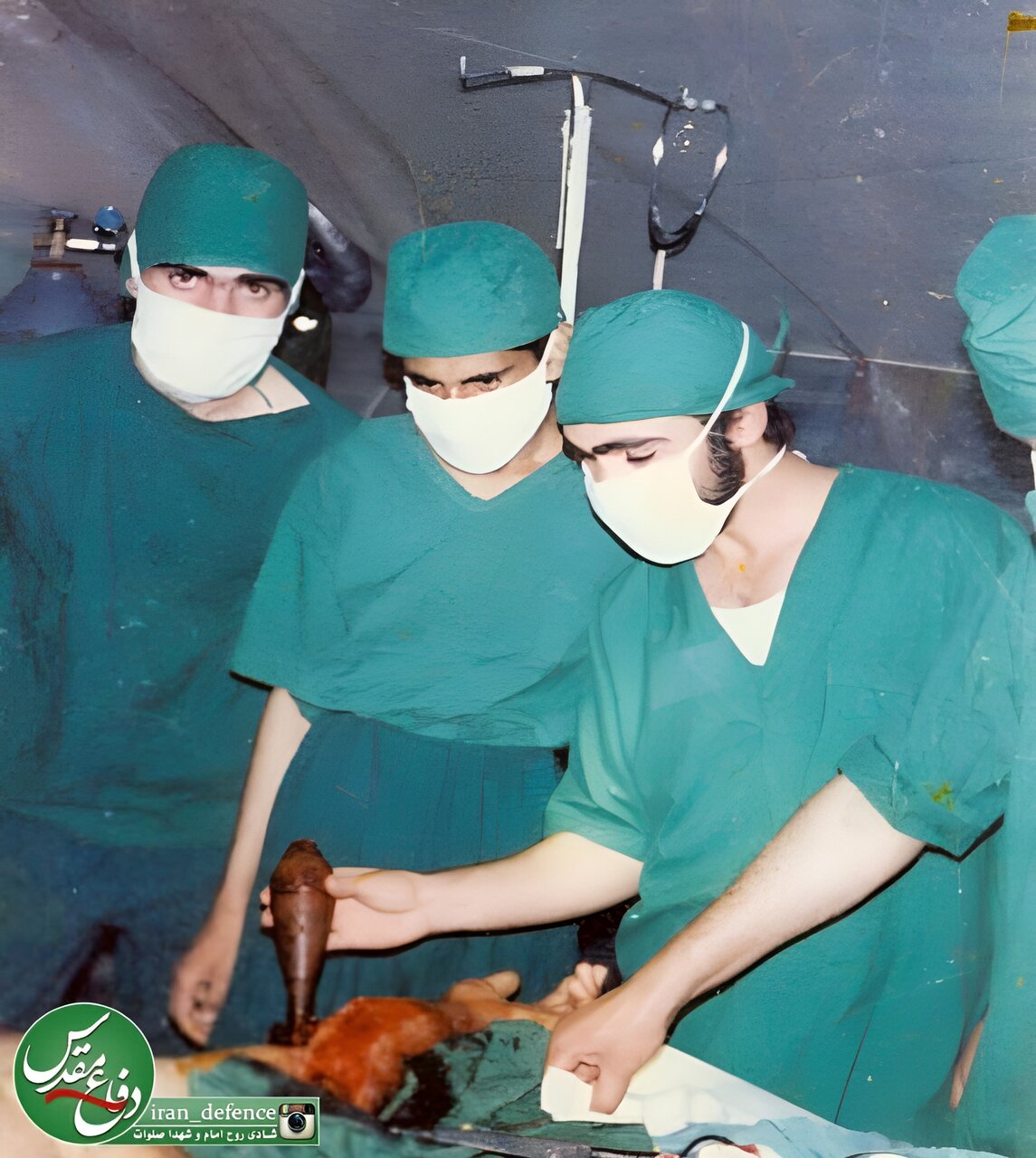 خنثی کردن خمپاره ۶۰ در اتاق عمل+ عکس