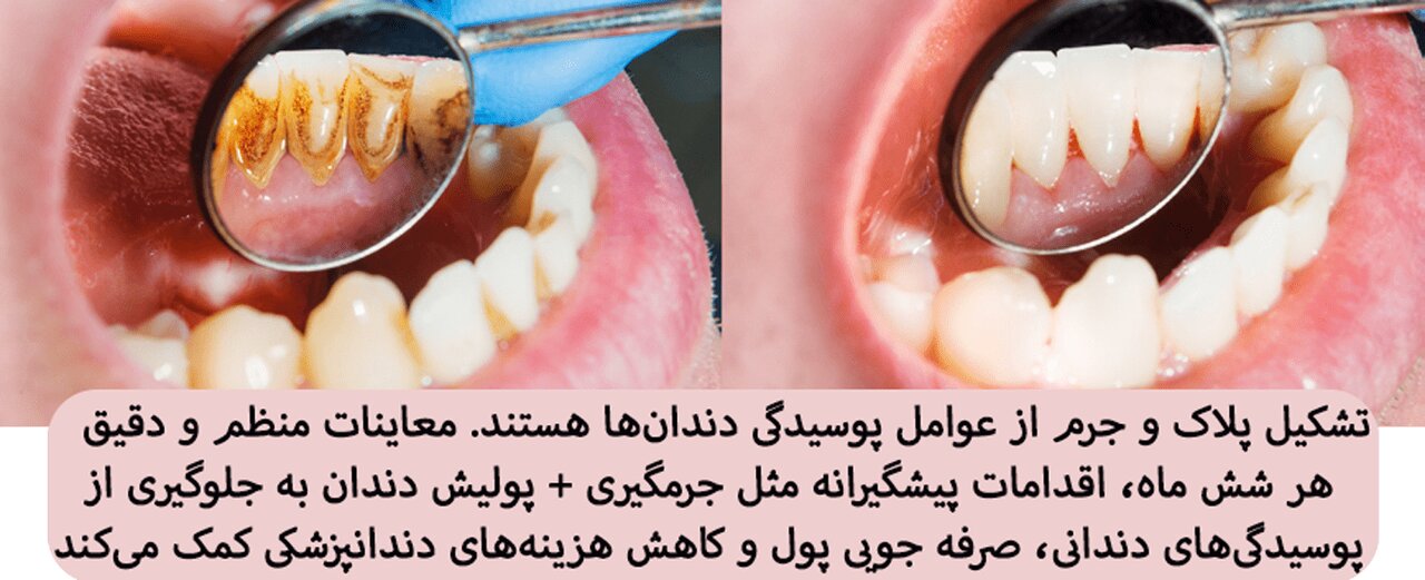 راهکار کاهش هزینههای دندانپزشکی و سلامت دندان