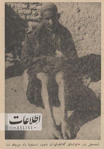 خانوادهای که با دست راه میروند/ عکس