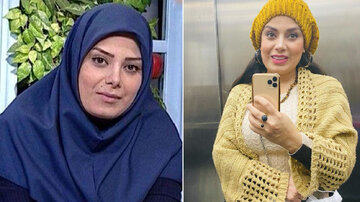 عکس |‌ تغییر چهره مجری زن سابق تلویزیون پس از جراحی‌های زیبایی!