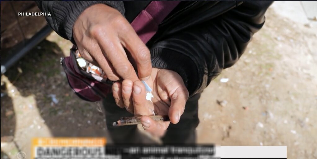 بلایی که «زامبی» بر سر بدن میآورد