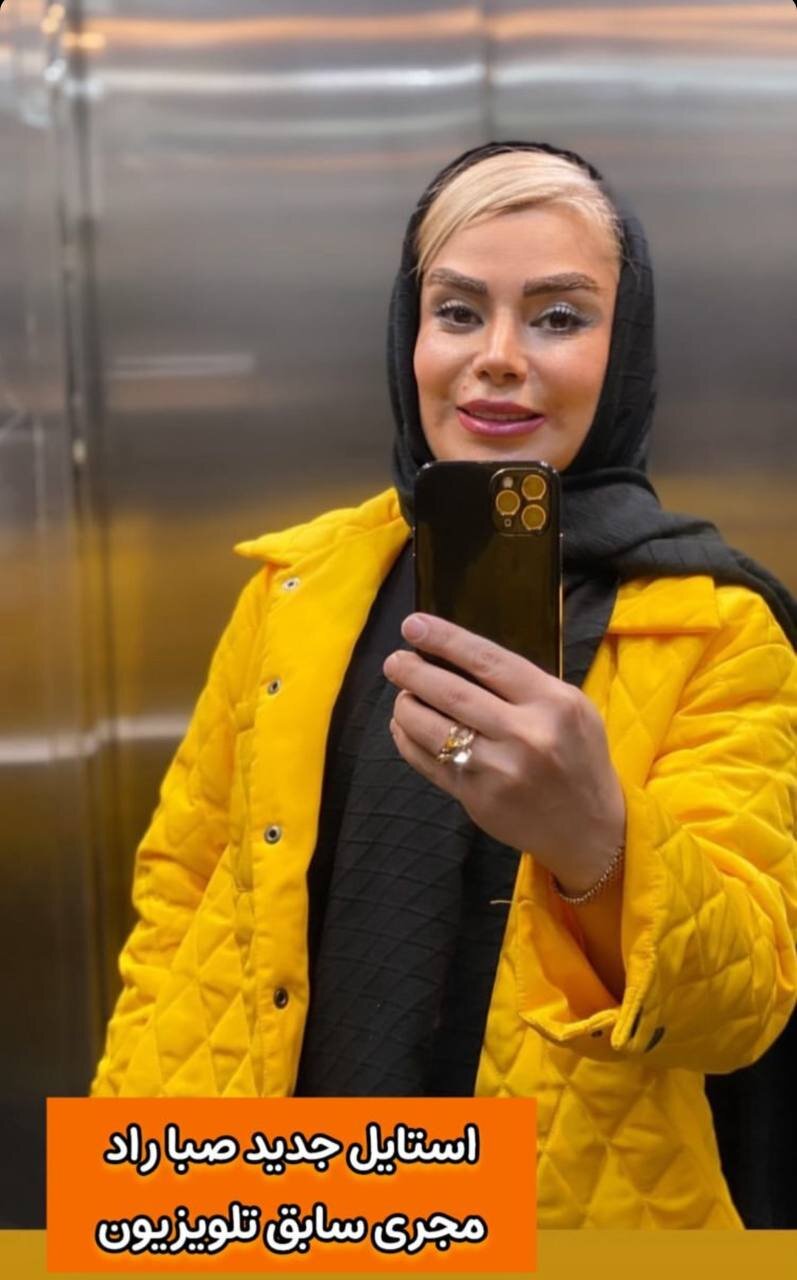 عکس | تغییر چهره مجری زن سابق تلویزیون پس از جراحیهای زیبایی!