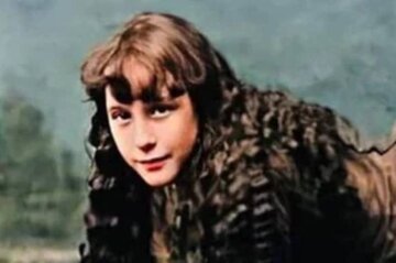 عکس | تصویری باورنکردنی از دختر شتری؛ درآمدزایی دختر جوان از بیماری مادرزادی‌اش!