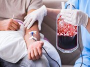 انتقاد مدیرعامل سازمان انتقال خون از پلاسما فروشی در بخش خصوصی