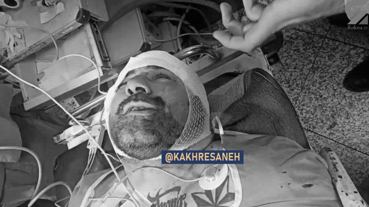 عکس | اولین تصویر از هانی کرده در اورژانس بیمارستان بعد از تیر خوردن در بهشت زهرا