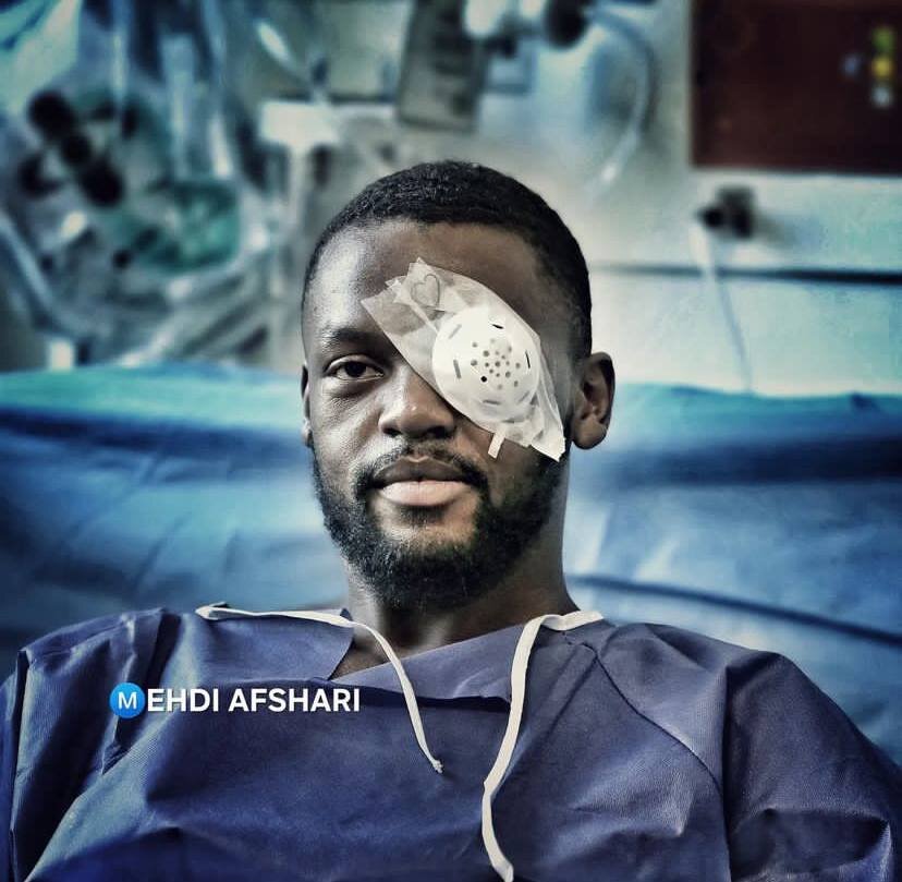 عکس| وضعیت نگرانکننده چشمِ کوین یامگا؛ ستاره استقلال فعلا بینایی کاملی ندارد!