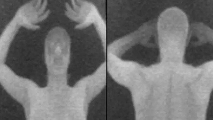 اسکنرهای بدننما در فرودگاهها که سر و صدای زیادی بپا کرد/ عکس