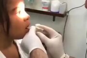 ببینید | تکنیک حرفه‌ای یک دکتر برای خارج کردن سکه از گلوی کودک!