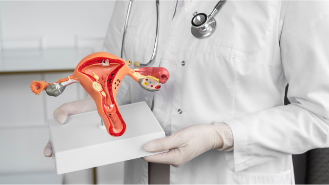 تنبلی تخمدان خطر مرگ در سنین پایین را افزایش میدهد