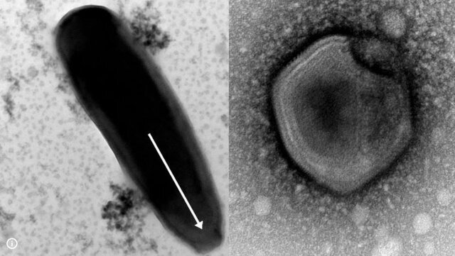 کشف عجیب و ترسناک دانشمندان/ حمله ویروس زامبی چقدر محتمل است؟