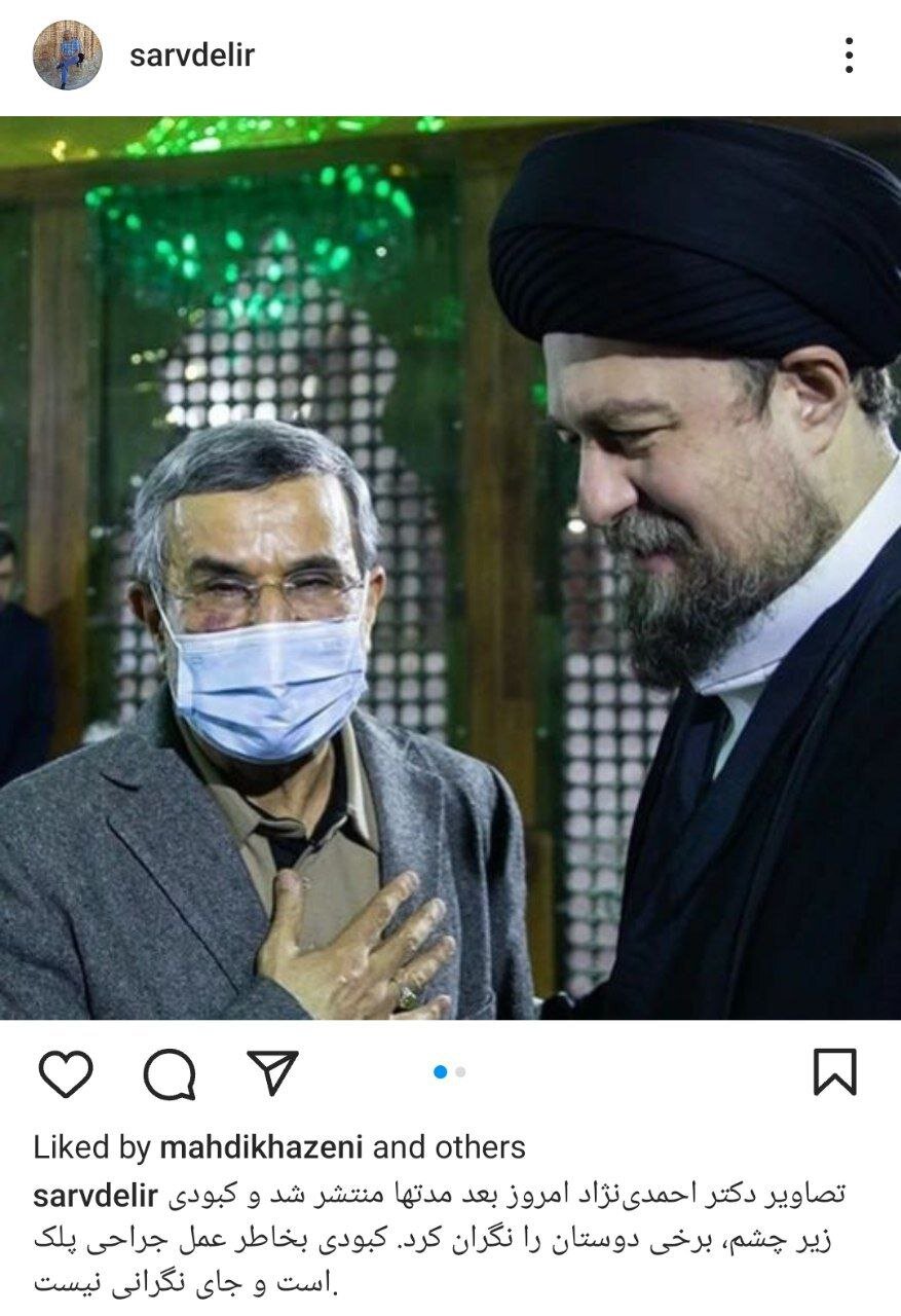 افشای دلیل کبودی صورت احمدی نژاد +عکس