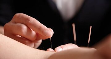 طب سوزنی خطر سکته مغزی را کاهش میدهد؟