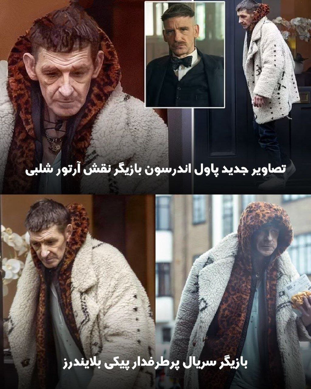 عکس | وضعیت فاجعهبار بازیگر مشهور؛ چهره متفاوت آرتور شلبی!