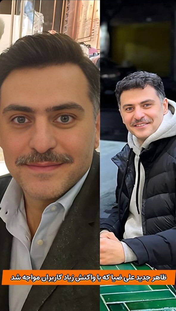 عکس | ظاهر جدید علی ضیا با سبیل!