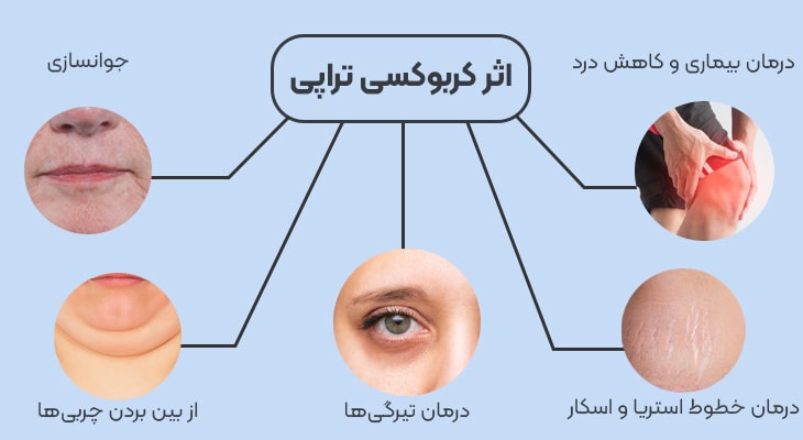 دو مورد از مهمترین تجهیزات پزشکی مورد نیاز برای کلینیکهای پوست و مو