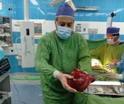 تومور سه و نیم کیلویی از کلیه یک بیمار 5۱ ساله در بیمارستان امام حسین (ع) تربت حیدریه خارج شد