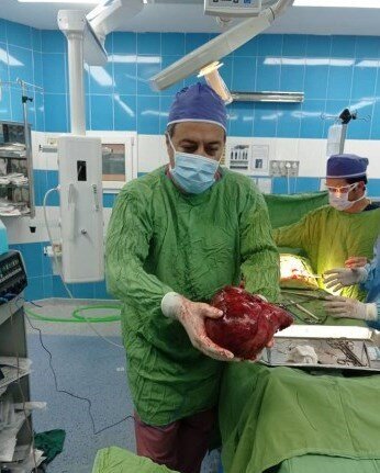 تومور ۳/۵ کیلویی در کلیه بیمار ۵۱ ساله/ عکس