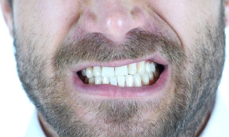 ۵ عادت که دندان‌تان را خراب می‌کند