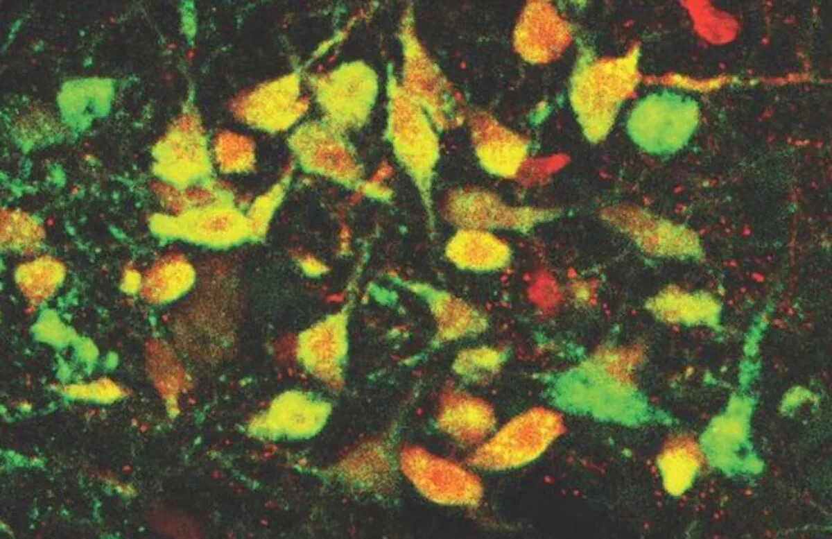 کشف کلید ترس در مغز / چطور خاموش میشود؟ 3 کشف کلید ترس در مغز / چطور خاموش میشود؟