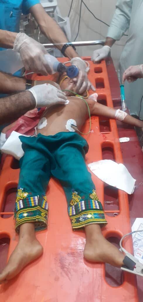 تصویر دلخراش کودک بلوچ مصدوم شده در حمله تروریستی